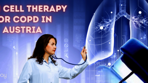 Stem Cell Therapy for COPD Patients in Austria