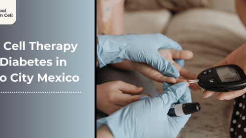 Stem Cell Therapy for Diabetes in Mexico City Mexico