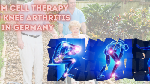 Stem Cell Therapy for Knee Arthritis in Germany