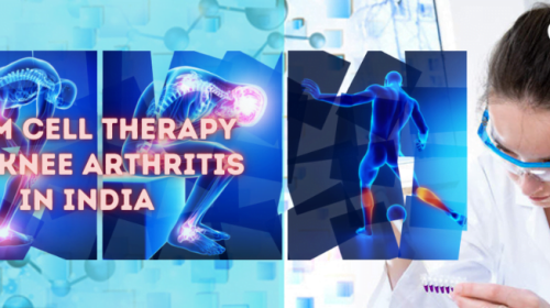 Stem Cell Therapy for Knee Arthritis in India