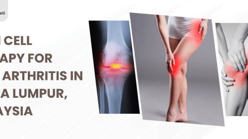 Stem Cell Therapy for Knee Arthritis in Kuala Lumpur, Malaysia