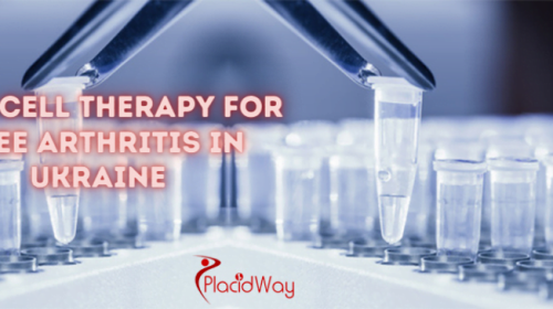 Stem Cell Therapy for Knee Arthritis in Ukraine