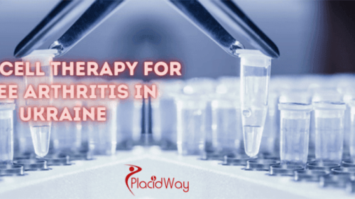 Stem Cell Therapy for Knee Arthritis in Ukraine