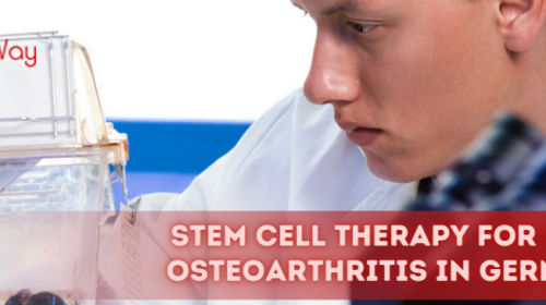 mesenchymal stem cell therapy for knee osteoarthritis
