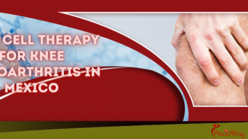 Stem Cell Therapy for Osteoarthritis of knees