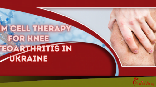 Stem Cell Treatment for Osteoarthritis in Knees