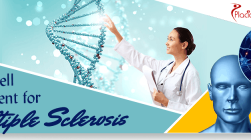 Stem Cell Therapy for Multiple Sclerosis in Germany