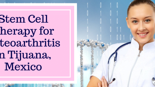 Stem Cell Therapy for Osteoarthritis in Tijuana, Mexico