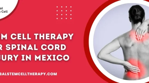 Stem Cell Therapy for Spinal Cord Injury in Mexico