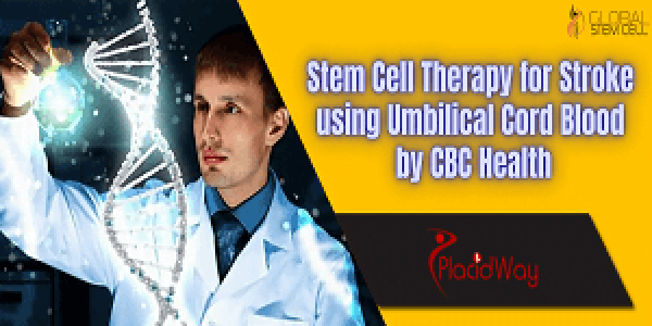 Stem Cell Therapy for Stroke using Umbilical Cord Blood by CBC Health - Thumbnail