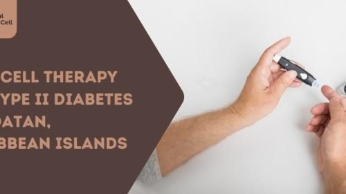 Stem Cell Therapy for Type II Diabetes in Roatan, Caribbean Islands