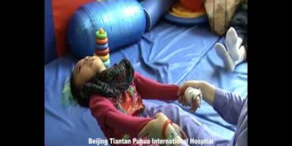 Stem Cell Treatment for Cerebral Palsy (CP): Jerica Cole