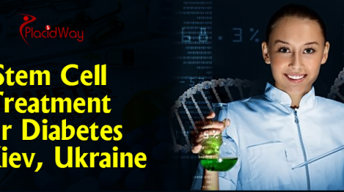 Stem Cell Treatment for Diabetes in Kiev, Ukraine
