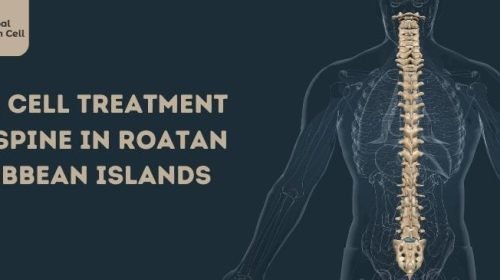 Stem Cell Treatment for Spine in Roatan Caribbean Islands