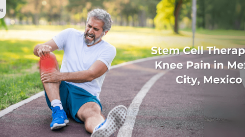 Stem Cell Therapy for Knee Pain in Mexico City, Mexico